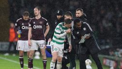 Celtic, esordio amaro per Nancy: gli Hearts vincono 2-1. E un gesto diventa virale