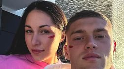 Roma, Dovbyk testimonial della campagna contro la violenza sulle donne