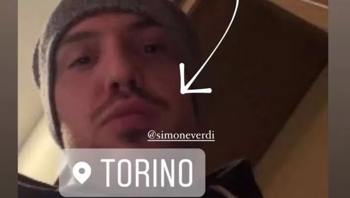 Torino, Verdi negativo: lo rende noto la compagna - immagine 1