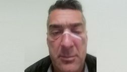 Video – Derby Pulcini, il genitore ferito: “Colpiti nel profondo. Disgusto e tristezza”