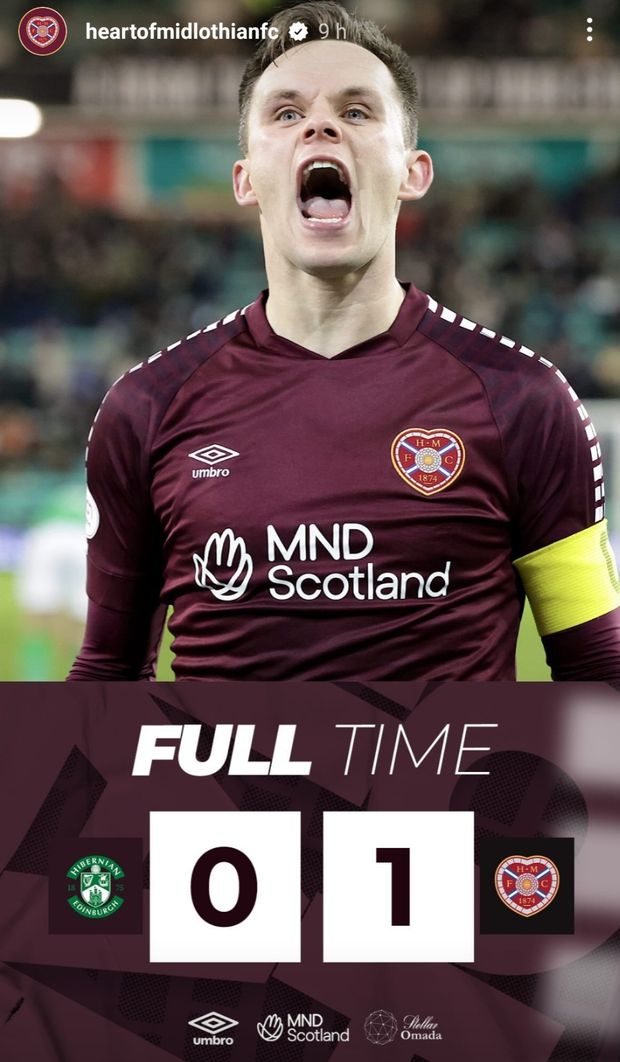 Edimburgo, due rigori finiti sul palo: poi ecco Shankland, l’eroe del derby…- immagine 2