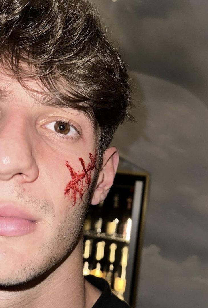 GALLERY È tempo di Halloween in casa Napoli: ecco i costumi dei calciatori azzurri - immagine 10