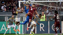 Nuovo 13 aprile nero per Szczęsny: operato alle ossa nasali dopo il derby