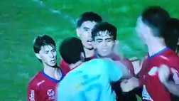 Follia in Uruguay, terribile pugno al volto dell’avversario che va ko