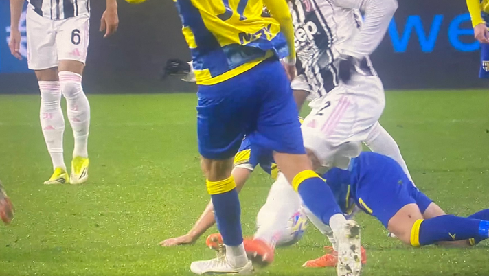 Episodio dubbio in Parma-Juventus Parma Juventus
