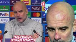 Manchester City, Guardiola pieno di graffi: la spiegazione è strana | VIDEO