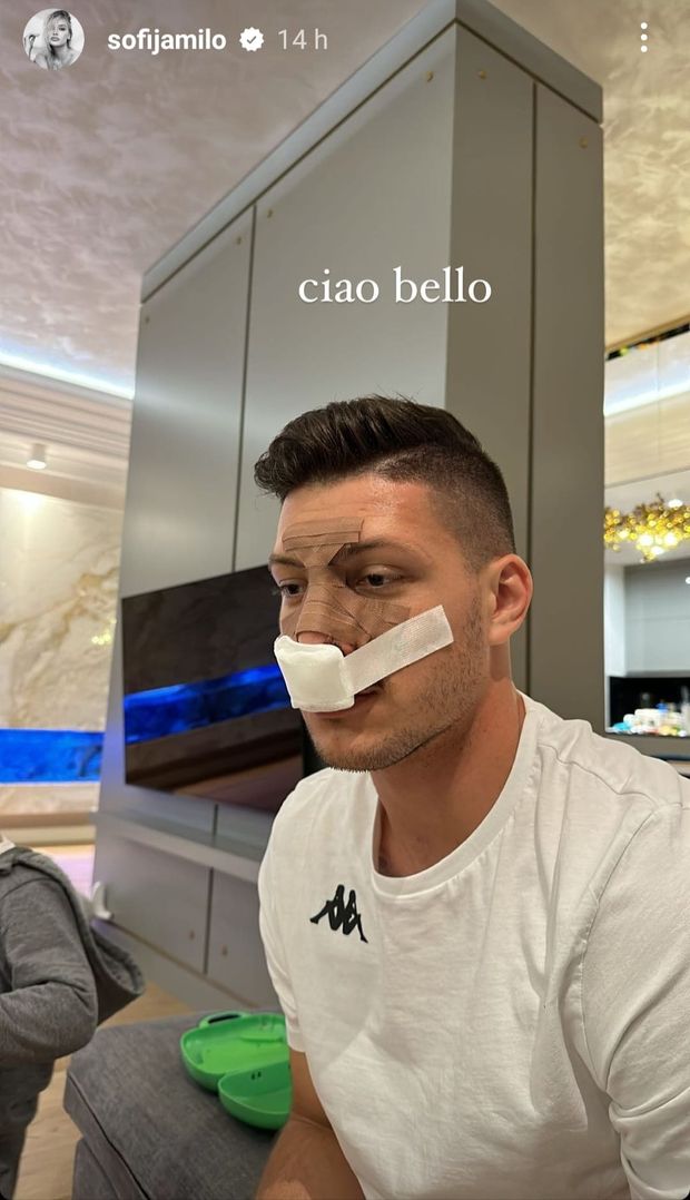 La botta di Praga lascia il segno, Jovic in campo con la maschera protettiva- immagine 2