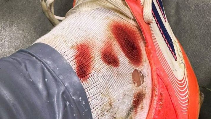 FOTO – Il doloroso “buongiorno” di David De Gea dopo lo scontro con Pulisic - immagine 1