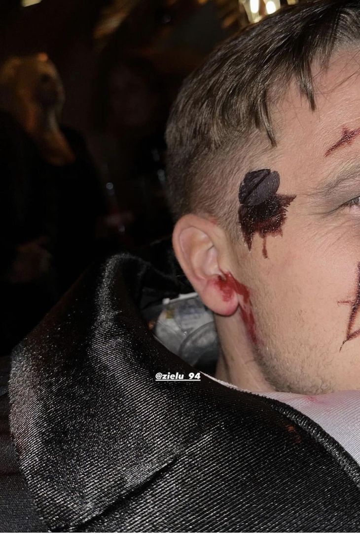 GALLERY È tempo di Halloween in casa Napoli: ecco i costumi dei calciatori azzurri- immagine 1