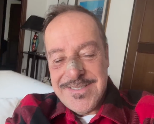 Massimo Lopez investito da un pirata della strada: “Uno scooter mi ha preso, denuncia fatta”- immagine 2