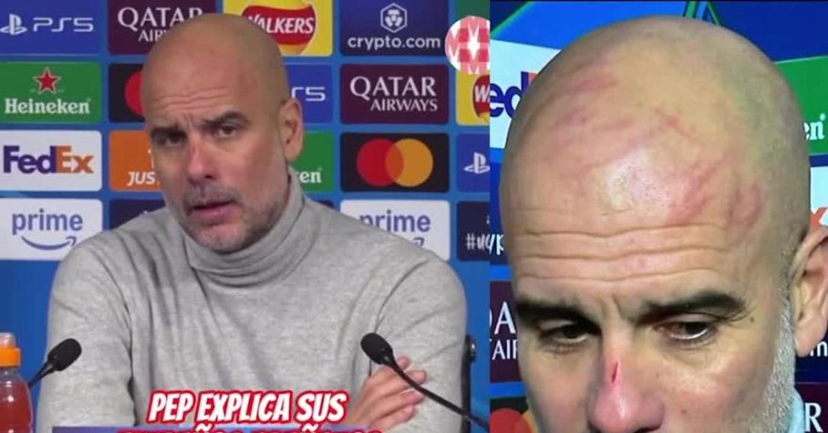 Manchester City, Guardiola pieno di graffi: la spiegazione è strana | VIDEO