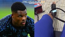 FCIN1908 / Dumfries operato alla caviglia, stop di oltre due mesi: i tempi di recupero