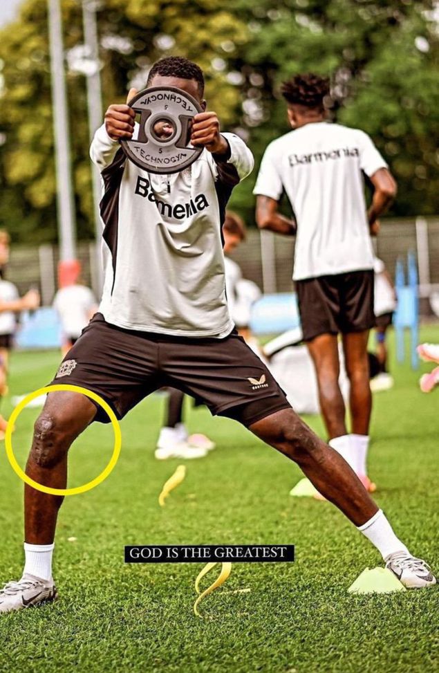 Boniface tra ginocchio e la scomparsa della mamma: “Ho pensato di ritirarmi”- immagine 2