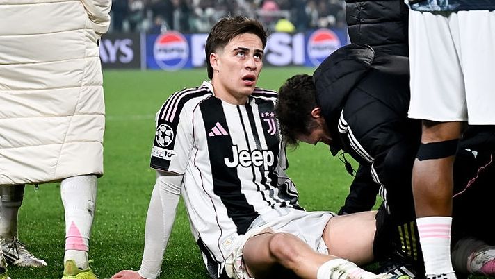 TURIN, ITALY - FEBRUARY 25: Kenan Yildiz of Juventus receives a massage before extra time during the UEFA Champions League 2025/26 League Knockout Play-off Second Leg match between Juventus and Galatasaray A.S. at Juventus Stadium on February 25, 2026 in Turin, Italy. (Photo by Daniele Badolato - Juventus FC/Juventus FC via Getty Images) Juve, il punto sull’infortunio di Yildiz e cosa filtra verso il Mondiale - immagine 1
