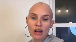 Bianca Balti senza capelli sui social dopo la chemio: “L’ho fatto”