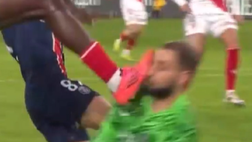 Donnarumma: scarpino in faccia e viso sanguinante! | VIDEO