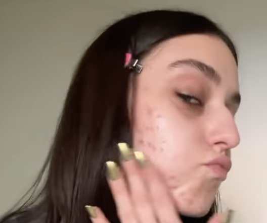 Domenica In, Gaia e lo sfogo di acne sul viso: “Bloccava la mia serenità, non voglio nascondermi”- immagine 2