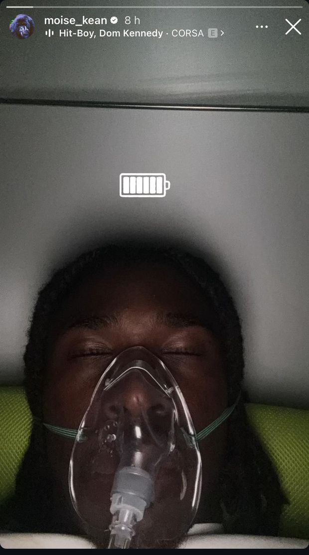 FOTO – Kean come Goku: il recupero con la maschera dell’ossigeno- immagine 2