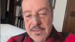 Massimo Lopez investito da un pirata della strada: “Uno scooter mi ha preso, denuncia fatta”