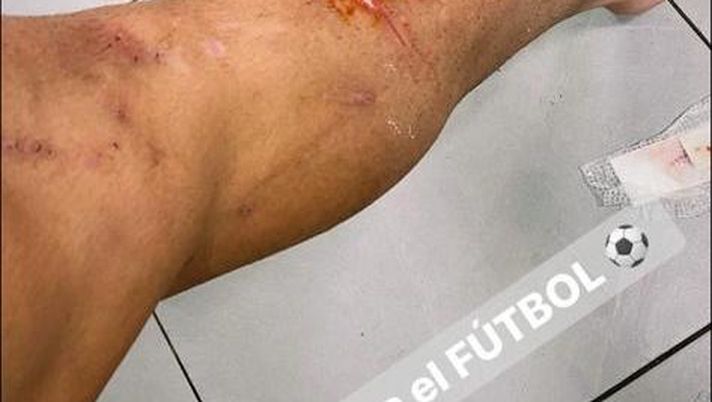 Rincon ferito in allenamento, lui la prende bene: “Lo apprezzo, fa parte del mestiere” Rincon