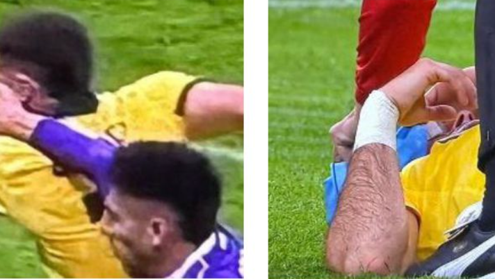 FOTO – Colpo a sinistra, ghiaccio a destra. Nazione: “La furbata di Gimenez” FOTO – Colpo a sinistra, ghiaccio a destra. Nazione: “La furbata di Gimenez” - immagine 1