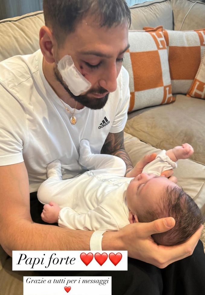 La moglie di Donnarumma posta un messaggio per i tifosi preoccupati dopo il trauma facciale- immagine 2