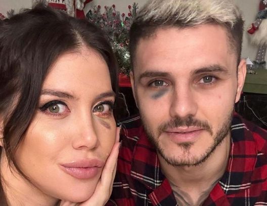 Polemiche per l’occhio nero di Icardi, Dzeko risponde sui social: “Ora piangono, imbarazzante” - immagine 1