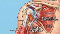 Lazio, infortunio Provedel: in cosa consiste la lesione del legamento gleno-omerale