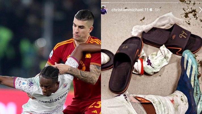 Fiorentina, Kouame mostra la gamba colpita duro da Lukaku: “Ringrazio Dio”  FOTO - immagine 1