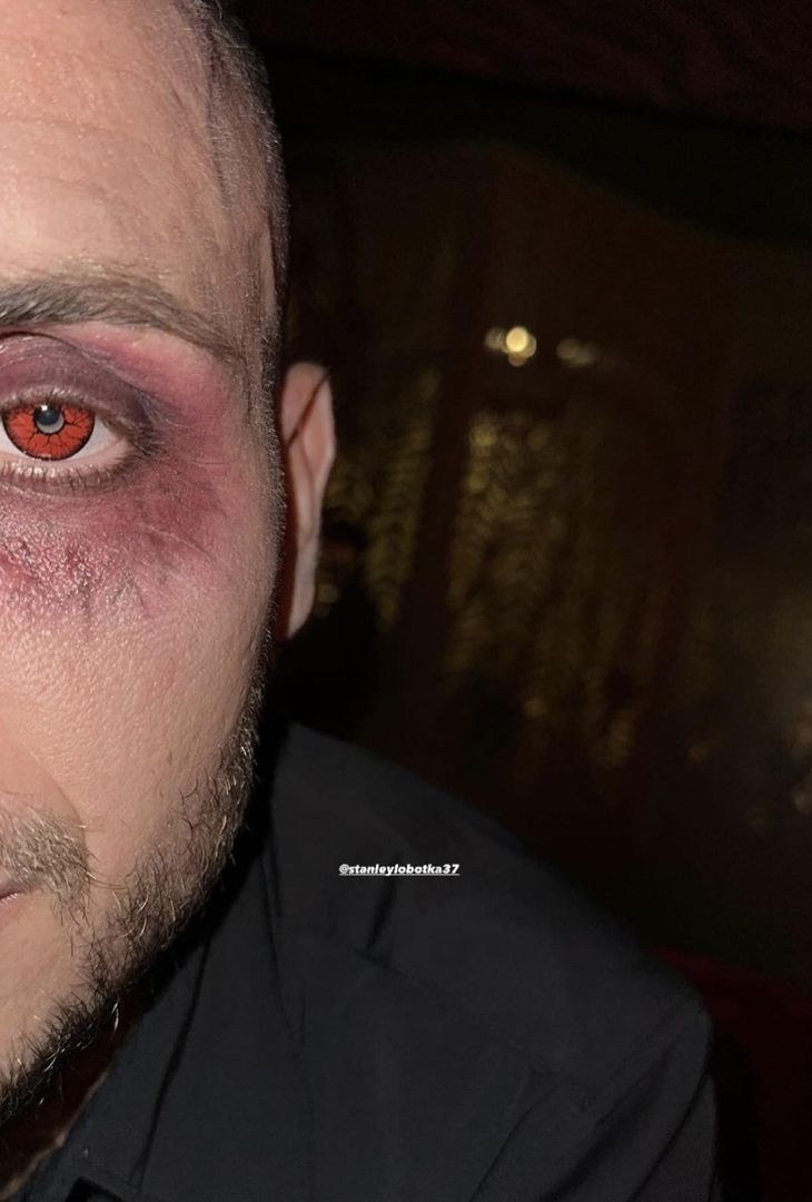 GALLERY È tempo di Halloween in casa Napoli: ecco i costumi dei calciatori azzurri - immagine 13