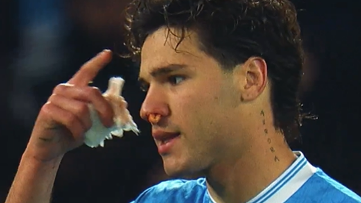 Napoli-Fiorentina, il momento in cui Vergara finisce ko: “Mi gira la testa!” - immagine 1