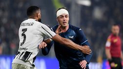 Juve-Lazio, Top&Flop: che amarezza, che delusione