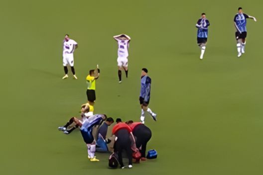 Brasile, infortunio gravissimo per Marlon: Gremio e Vitoria sotto shock- immagine 2