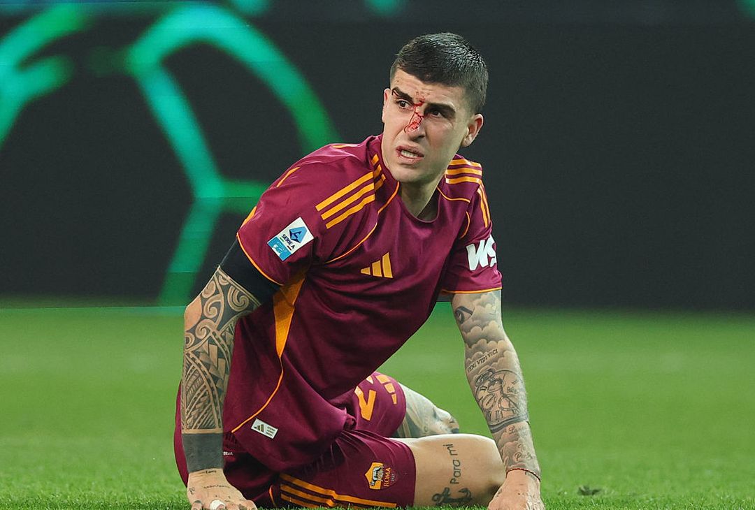 Udinese-Roma 1-0 FOTO GALLERY - immagine 10
