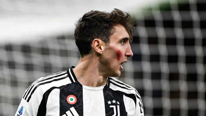 Juve, la caviglia continua a tormentare Cambiaso: oggi niente lavoro col gruppo - immagine 1