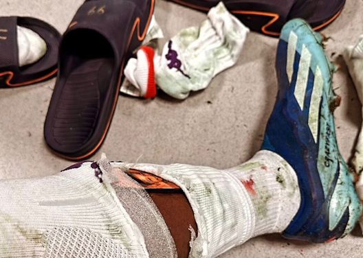 FOTO – Caro Mourinho, guarda Kouamè: lo scontro con Lukaku si sente! - immagine 1