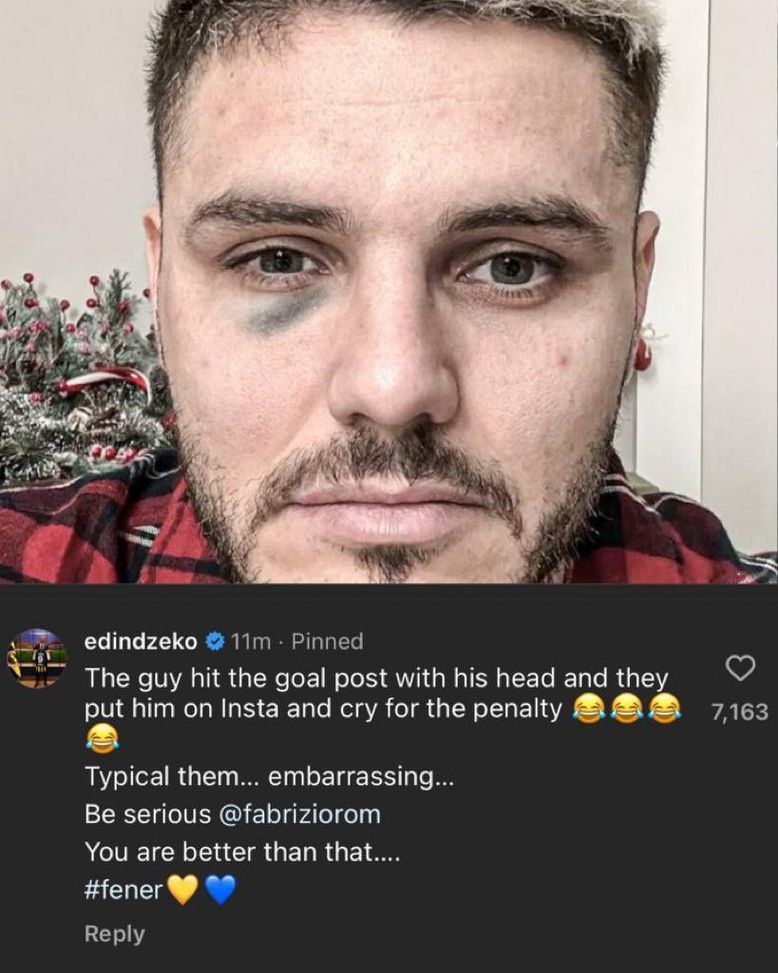 Icardi con l’occhio nero sui social dopo il derby di Istanbul: Dzeko “Sei imbarazzante”- immagine 2