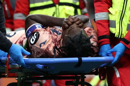 Il grido d’allarme del calcio: è record infortuni, in serie A sono già 88- immagine 2
