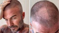 Ex Milan, Beckham combina un guaio e la moglie lo prende in giro | VIDEO