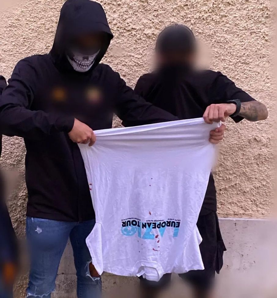 Derby della Capitale, agguato dei romanisti ai laziali rientrati da Glasgow- immagine 2