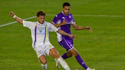 Carrarese, messe all’asta per il Meyer le maglie della gara con la Fiorentina