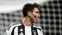 Juve, la caviglia continua a tormentare Cambiaso: oggi niente lavoro col gruppo