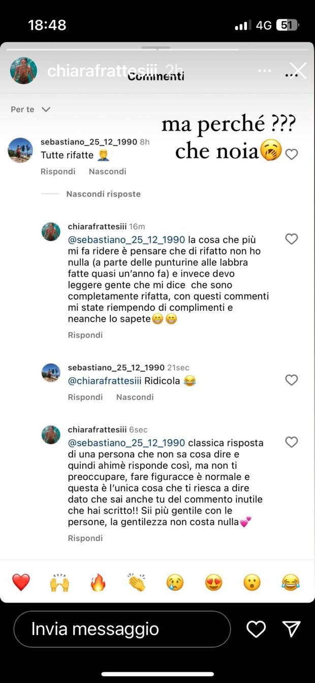 “Tutte rifatte”. Chiara Frattesi non ci sta e risponde: “La cosa che più mi fa ridere…”- immagine 2