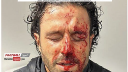 Incidenti Marsiglia-Lione, arriva la prima condanna con pena sospesa