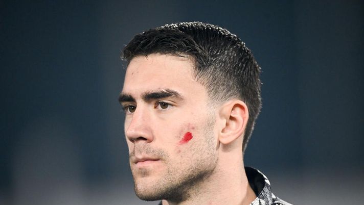 Serie A, torna un ‘rosso contro la violenza”. Casini: “Daspo è un modello” - immagine 1