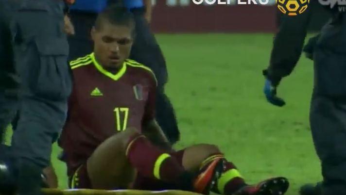 Torino, ansia anche per Martinez: gol, poi esce in barella - immagine 1