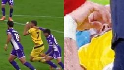 Milan, figuraccia Gimenez: che simulazione. Cds: “Colpito a sinistra ma curato a destra”