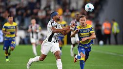 Parma-Juventus, dove vedere il match in diretta tv e streaming LIVE