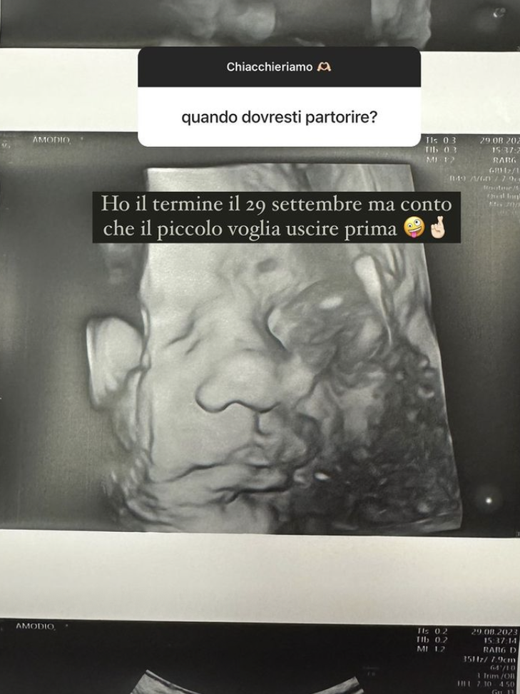 Giulia Amodio: “Quando il parto? Ho il termine il 29 settembre ma conto che…”- immagine 2