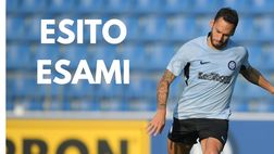 News Inter / Ansia Calhanoglu: ecco l’esito degli esami